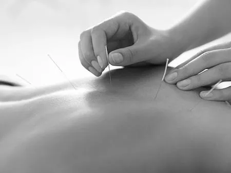 Acupuncture Branding Design and Marketing
